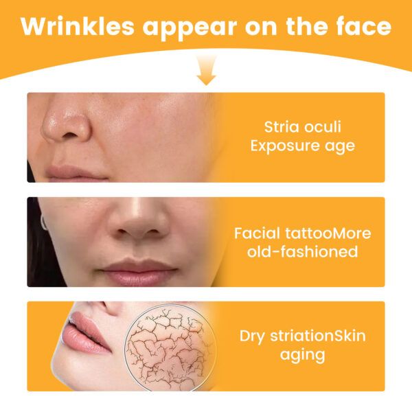 EELHOE Nasolabial Folds Patch, Fade Fine Lines Law Lines Lifting And Tightening Facial Skin Moisturizing And Hydrating - Image 2